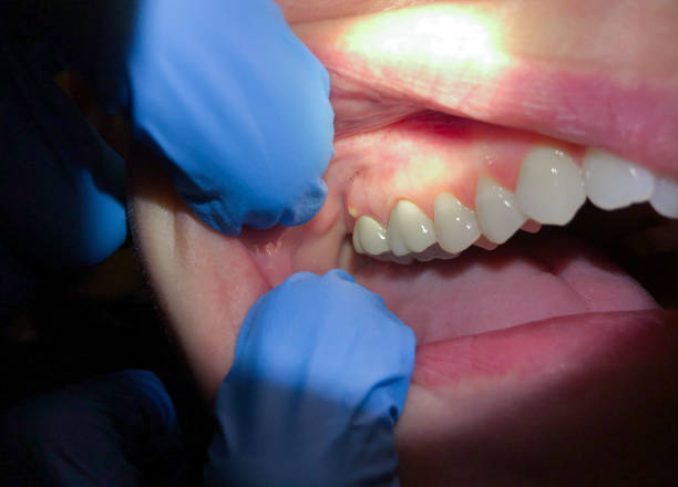 Best Emergency Root Canal Treatment in Camden, TN
