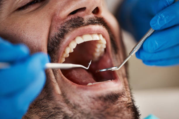 Best Emergency Dental Extractions in Camden, TN